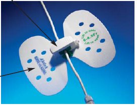 BD VUPD1214 StatLock Stabilization Device