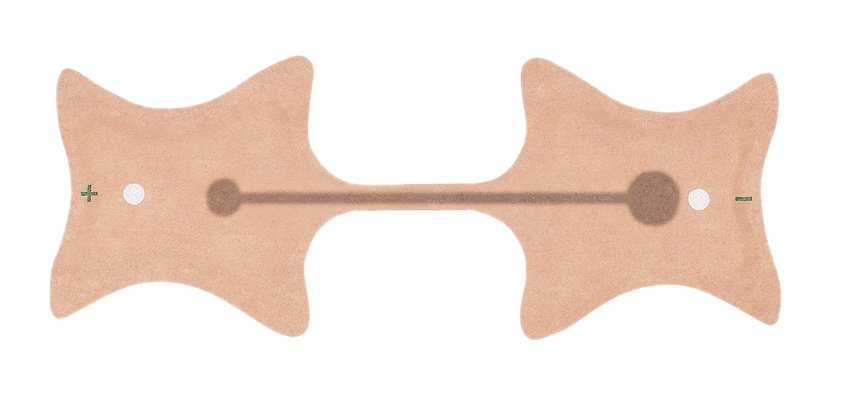 Iontophoresis Electrode Kit IontoPatch® 80 1.2 to 1.6 cc Fill Volume 6/Pk