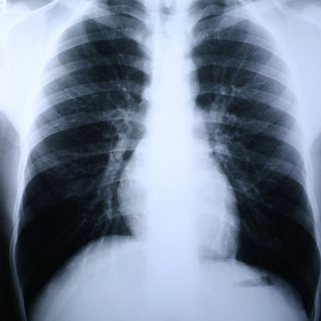 McKesson 55BTL Clear Choice Performance X-Ray Film