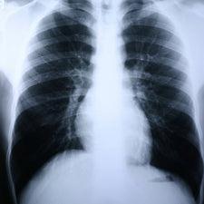 Clear Choice™ Performance X-Ray Film