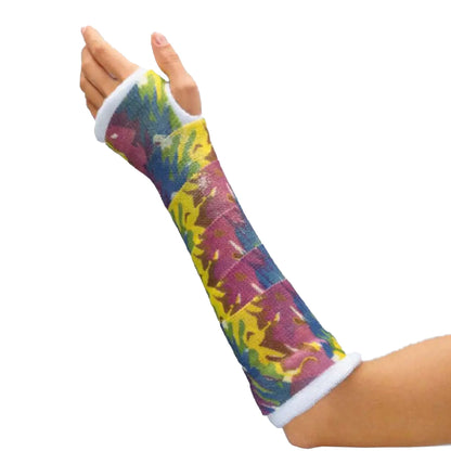 Cast Tape Delta-Cast® Prints 2 Inch X 12 Foot Polyester Pastel Print