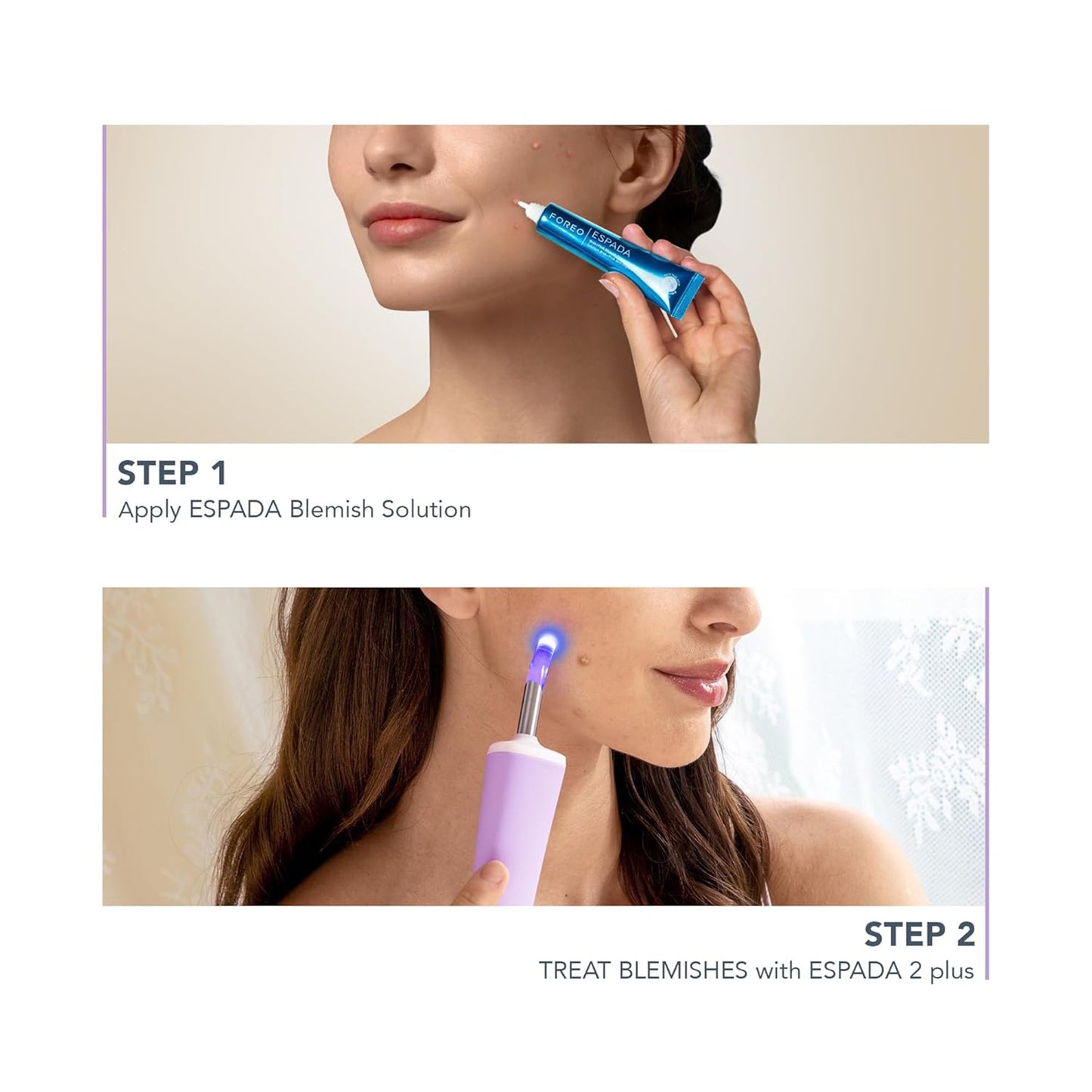 ESPADA™ 2 Plus Acne Therapy Device, Lavender