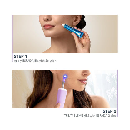 ESPADA™ 2 Plus Acne Therapy Device, Lavender