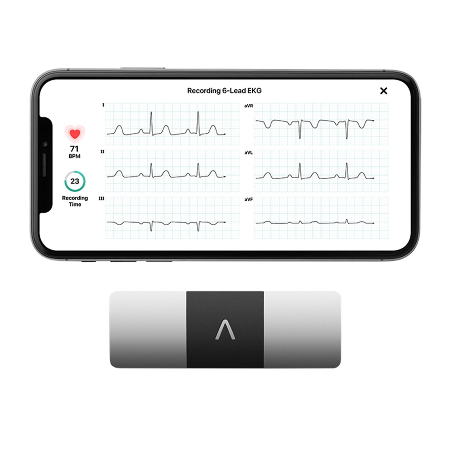 KardiaMobile® 6L Electrocardiograph