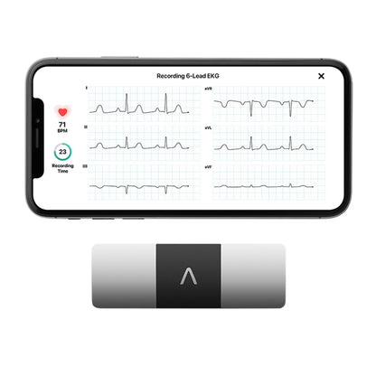 KardiaMobile® 6L Electrocardiograph